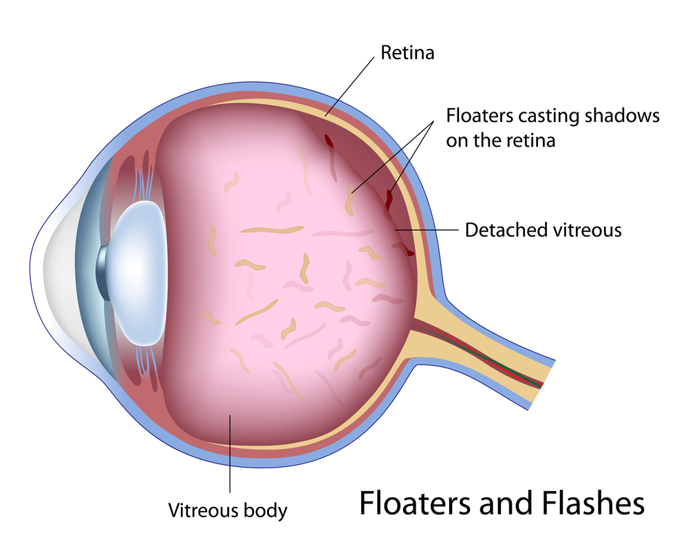 Eyelid Surgery and Specialty Eye Care Redding Red Bluff Chico CA